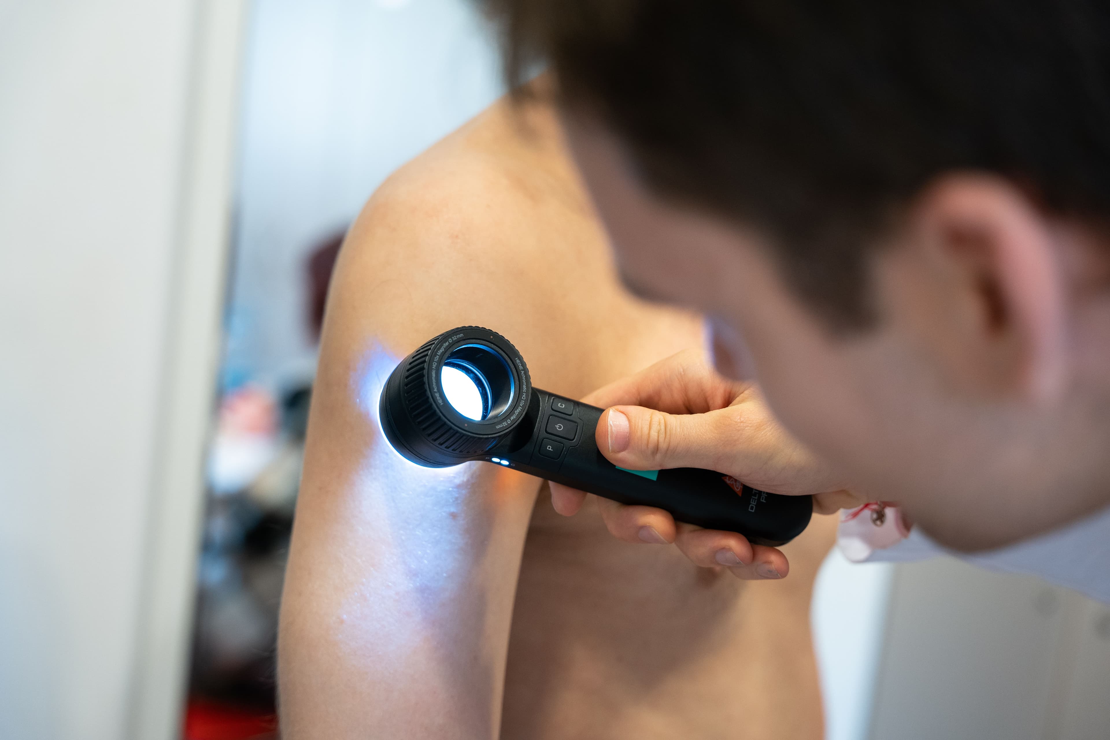 V olomouckém MAPO care spouštíme dermatologickou ambulanci